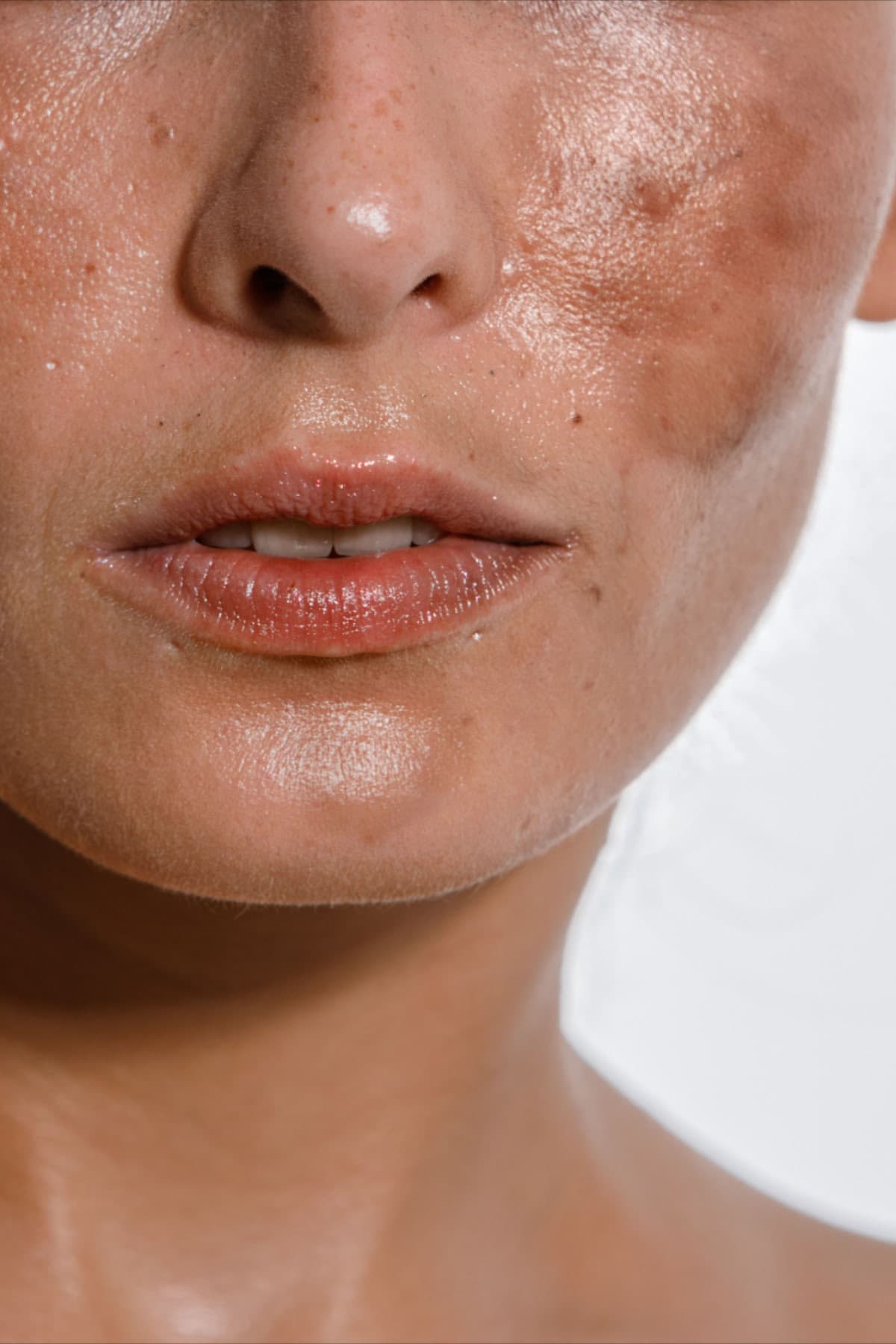 Dark Spots & Brightening