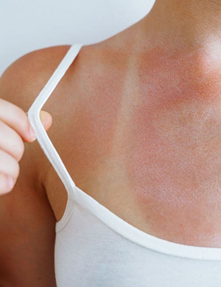 Sun Protection